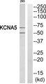 KCNA5 / Kv1.5 Antibody - Western blot analysis of extracts from 293 cells, using KCNA5 antibody.