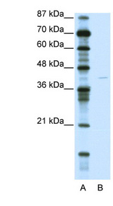 KCNA7 / Kv1.7 Antibody - KCNA7 / Kv1.7 antibody Western blot of Jurkat lysate. This image was taken for the unconjugated form of this product. Other forms have not been tested.