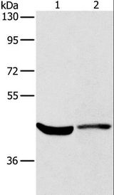 KCNA7 / Kv1.7 Antibody - Western blot analysis of HeLa cell and mouse kidney tissue, using KCNA7 Polyclonal Antibody at dilution of 1:550.