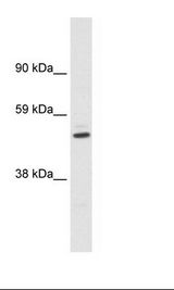 KCNAB1 Antibody - Fetal Kidney Lysate.  This image was taken for the unconjugated form of this product. Other forms have not been tested.