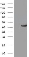 KCNAB1 Antibody - HEK293T cells were transfected with the pCMV6-ENTRY control (Left lane) or pCMV6-ENTRY KCNAB1 (Right lane) cDNA for 48 hrs and lysed. Equivalent amounts of cell lysates (5 ug per lane) were separated by SDS-PAGE and immunoblotted with anti-KCNAB1.