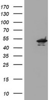 KCNAB1 Antibody - HEK293T cells were transfected with the pCMV6-ENTRY control (Left lane) or pCMV6-ENTRY KCNAB1 (Right lane) cDNA for 48 hrs and lysed. Equivalent amounts of cell lysates (5 ug per lane) were separated by SDS-PAGE and immunoblotted with anti-KCNAB1.