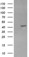 KCNAB1 Antibody - HEK293T cells were transfected with the pCMV6-ENTRY control (Left lane) or pCMV6-ENTRY KCNAB1 (Right lane) cDNA for 48 hrs and lysed. Equivalent amounts of cell lysates (5 ug per lane) were separated by SDS-PAGE and immunoblotted with anti-KCNAB1.