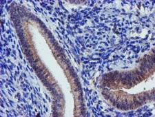 KCNAB1 Antibody - IHC of paraffin-embedded Human endometrium tissue using anti-KCNAB1 mouse monoclonal antibody. (Heat-induced epitope retrieval by 10mM citric buffer, pH6.0, 120°C for 3min).