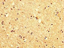 KCNAB1 Antibody - Immunohistochemistry image at a dilution of 1:200 and staining in paraffin-embedded human brain tissue performed on a Leica BondTM system. After dewaxing and hydration, antigen retrieval was mediated by high pressure in a citrate buffer (pH 6.0) . Section was blocked with 10% normal goat serum 30min at RT. Then primary antibody (1% BSA) was incubated at 4 °C overnight. The primary is detected by a biotinylated secondary antibody and visualized using an HRP conjugated SP system.
