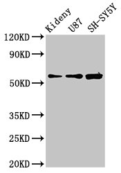 KCNAB1 Antibody - Positive Western Blot detected in Mouse kidney tissue, U87 whole cell lysate, SH-SY5Y whole cell lysate. All lanes: KCNAB1 antibody at 3.9 µg/ml Secondary Goat polyclonal to rabbit IgG at 1/50000 dilution. Predicted band size: 47, 45, 46 KDa. Observed band size: 60 KDa