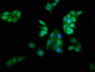 KCNAB1 Antibody - Immunofluorescence staining of HepG2 cells with KCNAB1 Antibody at 1:66, counter-stained with DAPI. The cells were fixed in 4% formaldehyde, permeabilized using 0.2% Triton X-100 and blocked in 10% normal Goat Serum. The cells were then incubated with the antibody overnight at 4°C. The secondary antibody was Alexa Fluor 488-congugated AffiniPure Goat Anti-Rabbit IgG(H+L).