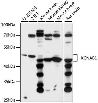 KCNAB1 Antibody - Western blot analysis of extracts of various cell lines, using KCNAB1 antibody at 1:1000 dilution. The secondary antibody used was an HRP Goat Anti-Rabbit IgG (H+L) at 1:10000 dilution. Lysates were loaded 25ug per lane and 3% nonfat dry milk in TBST was used for blocking. An ECL Kit was used for detection and the exposure time was 10s.