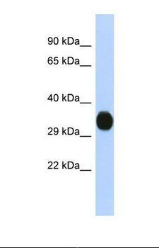 KCNAB2 / Kv-Beta-2 Antibody - Western blot of Human Fetal Brain. KCNAB2 antibody dilution 1.0 ug/ml.  This image was taken for the unconjugated form of this product. Other forms have not been tested.