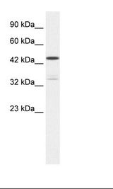 KCNAB3 Antibody - Jurkat Cell Lysate.  This image was taken for the unconjugated form of this product. Other forms have not been tested.