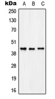 KCNAB3 Antibody - Western blot analysis of KCNAB3 expression in THP1 (A); rat brain (B); rat kidney (C) whole cell lysates.