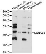 KCNAB3 Antibody - Western blot analysis of extracts of various cell lines, using KCNAB3 antibody at 1:1000 dilution. The secondary antibody used was an HRP Goat Anti-Rabbit IgG (H+L) at 1:10000 dilution. Lysates were loaded 25ug per lane and 3% nonfat dry milk in TBST was used for blocking. An ECL Kit was used for detection and the exposure time was 90s.