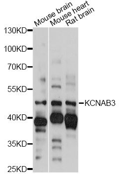 KCNAB3 Antibody - Western blot analysis of extracts of various cell lines, using KCNAB3 antibody at 1:1000 dilution. The secondary antibody used was an HRP Goat Anti-Rabbit IgG (H+L) at 1:10000 dilution. Lysates were loaded 25ug per lane and 3% nonfat dry milk in TBST was used for blocking. An ECL Kit was used for detection and the exposure time was 10s.