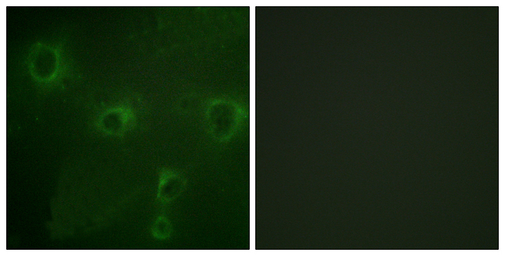 KCNB1 / Kv2.1 Antibody - Immunofluorescence analysis of COS7 cells, using Kv2.1/KCNB1 Antibody. The picture on the right is blocked with the synthesized peptide.