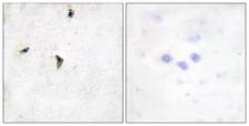 KCNB1 / Kv2.1 Antibody - Immunohistochemistry analysis of paraffin-embedded human brain tissue, using Kv2.1/KCNB1 Antibody. The picture on the right is blocked with the synthesized peptide.