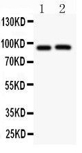 KCNB1 / Kv2.1 Antibody - Kv2.1 antibody Western blot. All lanes: Anti KV2.1 at 0.5 ug/ml. Lane 1: Rat Brain Tissue Lysate at 50 ug. Lane 2: Mouse Brain Tissue Lysate at 50 ug. Predicted band size: 96 kD. Observed band size: 96 kD.