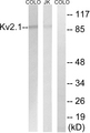 KCNB1 / Kv2.1 Antibody - Western blot of extracts from COLO cells and Jurkat cells, using Kv2.1 (Ab-805) antibody.