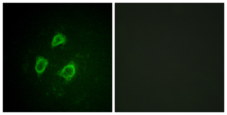 KCNB1 / Kv2.1 Antibody - Immunofluorescence analysis of HepG2 cells, using Kv2.1/KCNB1 (Phospho-Ser567) Antibody. The picture on the right is blocked with the phospho peptide.