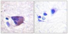 KCNB1 / Kv2.1 Antibody - Immunohistochemistry analysis of paraffin-embedded human brain, using Kv2.1/KCNB1 (Phospho-Ser567) Antibody. The picture on the right is blocked with the phospho peptide.