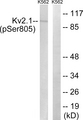 KCNB1 / Kv2.1 Antibody - Western blot analysis of lysates from K562 cells treated with TNF 200ng/ml 30', using Kv2.1 (Phospho-Ser805) Antibody. The lane on the right is blocked with the phospho peptide.