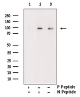 KCNB1 / Kv2.1 Antibody - Western blot analysis of Phospho-Kv2.1 (Ser805) antibody expression in TNF treated K562 cells lysates. The lane on the right is treated with the antigen-specific peptide.