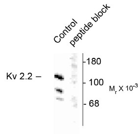 KCNB2 / Kv2.2 Antibody - Western blot of rat brain homogenate showing specific immunolabeling of the ~125k voltage-gated potassium channel, Kv2.2 (Control). The immunolabeling is blocked by preadsorption with the peptide used as antigen (Peptide Block).
