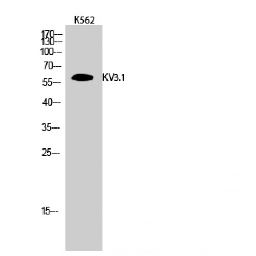 KCNC1 / Kv3.1 Antibody - Western blot of KV3.1 antibody