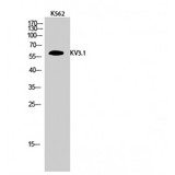 KCNC1 / Kv3.1 Antibody - Western blot of KV3.1 antibody