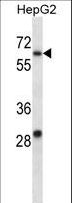 KCNC1 / Kv3.1 Antibody - KCNC1 Antibody western blot of HepG2 cell line lysates (35 ug/lane). The KCNC1 antibody detected the KCNC1 protein (arrow).