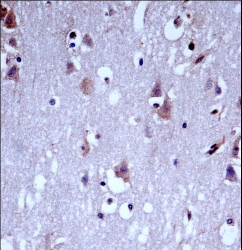 KCNC1 / Kv3.1 Antibody - KCNC1 Antibody immunohistochemistry of formalin-fixed and paraffin-embedded human brain tissue followed by peroxidase-conjugated secondary antibody and DAB staining.