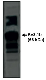 KCNC1 / Kv3.1 Antibody - Western blot of Kv3.1b antibody on rat brain lysate.