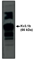 KCNC1 / Kv3.1 Antibody - Western blot of Kv3.1b antibody on rat brain lysate.