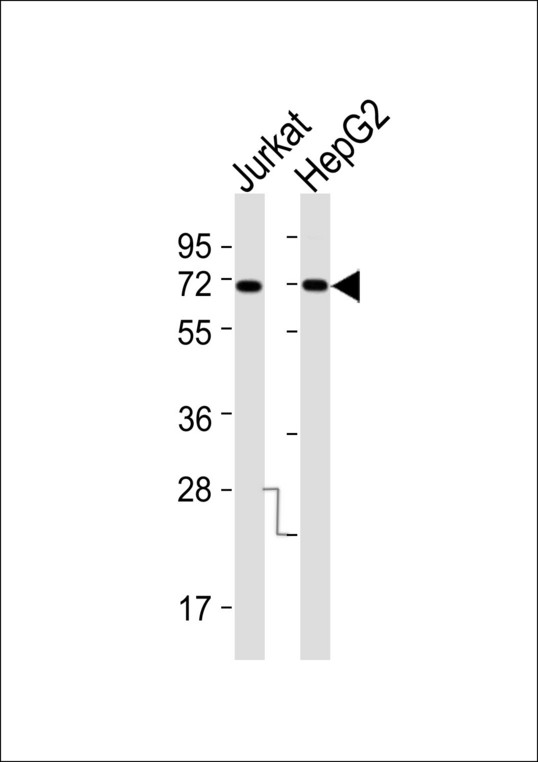 KCNC1 / Kv3.1 Antibody - All lanes : Anti-Kv3.1 Antibody at 1:1000 dilution Lane 1: Jurkat whole cell lysates Lane 2: HepG2 whole cell lysates Lysates/proteins at 20 ug per lane. Secondary Goat Anti-Rabbit IgG, (H+L),Peroxidase conjugated at 1/10000 dilution Predicted band size : 58 kDa Blocking/Dilution buffer: 5% NFDM/TBST.