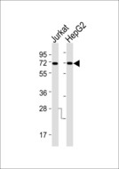 KCNC1 / Kv3.1 Antibody - All lanes : Anti-Kv3.1 Antibody at 1:1000 dilution Lane 1: Jurkat whole cell lysates Lane 2: HepG2 whole cell lysates Lysates/proteins at 20 ug per lane. Secondary Goat Anti-Rabbit IgG, (H+L),Peroxidase conjugated at 1/10000 dilution Predicted band size : 58 kDa Blocking/Dilution buffer: 5% NFDM/TBST.