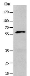 KCNC1 / Kv3.1 Antibody - Western blot analysis of Mouse liver tissue, using KCNC1 Polyclonal Antibody at dilution of 1:400.