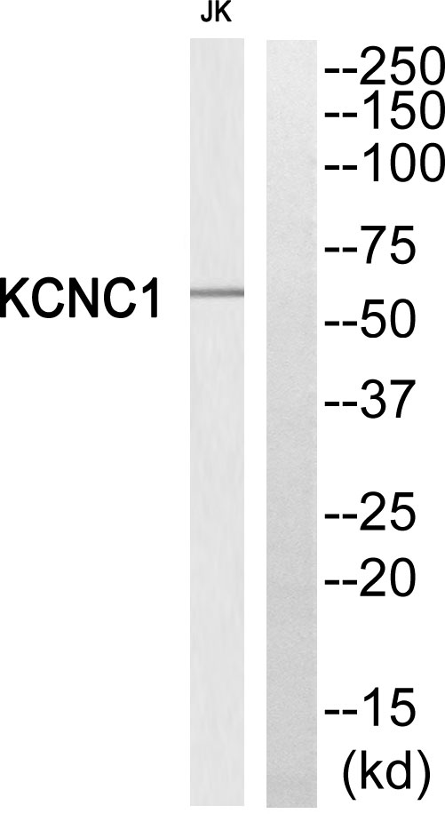 KCNC1 / Kv3.1 Antibody - Western blot of extracts from JK cells, using KCNC1 antibody.