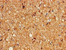 KCNC1 / Kv3.1 Antibody - Immunohistochemistry of paraffin-embedded human brain tissue using KCNC1 Antibody at dilution of 1:100