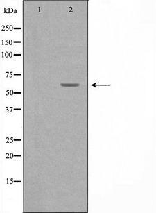 KCNC1 / Kv3.1 Antibody - Western blot analysis of extracts of JK cells using KCNC1 antibody. The lane on the left is treated with the antigen-specific peptide.