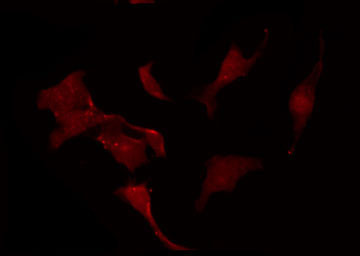 KCNC1 / Kv3.1 Antibody - Staining HeLa cells by IF/ICC. The samples were fixed with PFA and permeabilized in 0.1% Triton X-100, then blocked in 10% serum for 45 min at 25°C. The primary antibody was diluted at 1:200 and incubated with the sample for 1 hour at 37°C. An Alexa Fluor 594 conjugated goat anti-rabbit IgG (H+L) Ab, diluted at 1/600, was used as the secondary antibody.