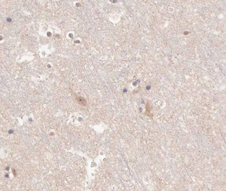 KCNC2 / Kv3.2 Antibody - 1:100 staining human brain tissue by IHC-P. The tissue was formaldehyde fixed and a heat mediated antigen retrieval step in citrate buffer was performed. The tissue was then blocked and incubated with the antibody for 1.5 hours at 22°C. An HRP conjugated goat anti-rabbit antibody was used as the secondary.