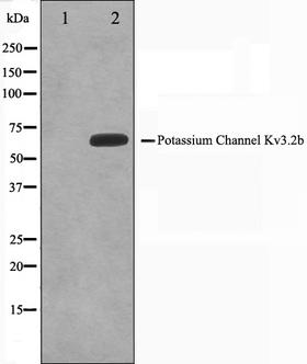 KCNC2 / Kv3.2 Antibody - Western blot analysis on HepG2 cell lysates using KCNC2 antibody. The lane on the left is treated with the antigen-specific peptide.