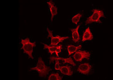 KCNC2 / Kv3.2 Antibody - Staining HepG2 cells by IF/ICC. The samples were fixed with PFA and permeabilized in 0.1% Triton X-100, then blocked in 10% serum for 45 min at 25°C. The primary antibody was diluted at 1:200 and incubated with the sample for 1 hour at 37°C. An Alexa Fluor 594 conjugated goat anti-rabbit IgG (H+L) Ab, diluted at 1/600, was used as the secondary antibody.