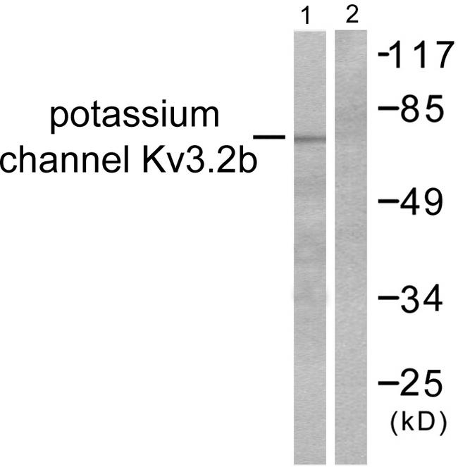 KCNC2 / Kv3.2 Antibody - Western blot analysis of extracts from HepG2 cells, using Potassium Channel Kv3.2b antibody.