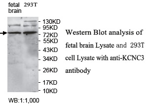 KCNC3 / Kv3.3 Antibody