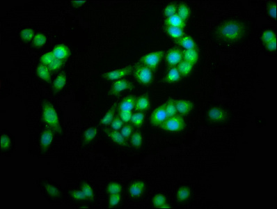 KCNC3 / Kv3.3 Antibody - Immunofluorescence staining of PC3 cells at a dilution of 1:100, counter-stained with DAPI. The cells were fixed in 4% formaldehyde, permeabilized using 0.2% Triton X-100 and blocked in 10% normal Goat Serum. The cells were then incubated with the antibody overnight at 4 °C.The secondary antibody was Alexa Fluor 488-congugated AffiniPure Goat Anti-Rabbit IgG (H+L) .