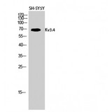 KCNC4 / Kv3.4 Antibody - Western blot of Kv3.4 antibody