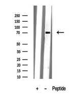 KCNC4 / Kv3.4 Antibody - Western blot analysis of extracts of mouse brain tissue sample using Kv3.4/KCNC4 antibody.