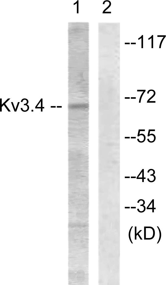 KCNC4 / Kv3.4 Antibody - Western blot analysis of extracts from COS7 cells, treated with Anisomycin (25ug/ml, 30mins), using Kv3.4/KCNC4 (Ab-15) antibody.