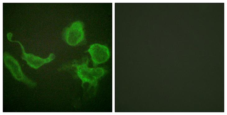 KCNC4 / Kv3.4 Antibody - Peptide - + Immunofluorescence analysis of HeLa cells, using Kv3.4/KCNC4 (Ab-15) antibody.