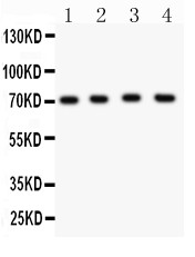 KCND1 / Kv4.1 Antibody - KCND1 antibody Western blot. All lanes: Anti KCND1 at 0.5 ug/ml. Lane 1: Mouse Brain Tissue Lysate at 50 ug. Lane 2: HELA Whole Cell Lysate at 40 ug. Lane 3: COLO320 Whole Cell Lysate at 40 ug. Lane 4: A549 Whole Cell Lysate at 40 ug. Predicted band size: 71 kD. Observed band size: 71 kD.